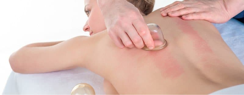 Running Cupping Therapy 25min